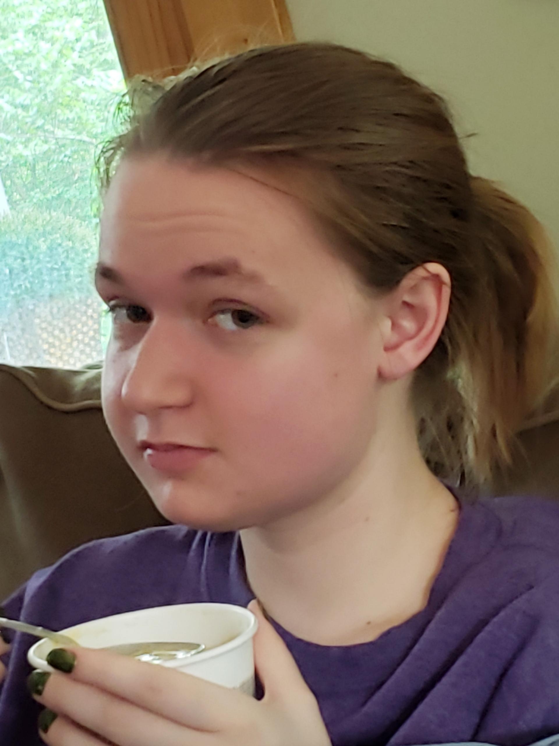 2021-07-23 Cate post wisdom teeth extraction.jpg